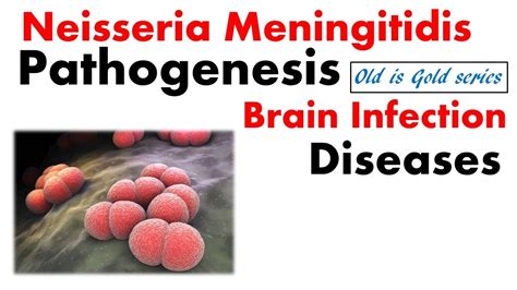 Gain Hope for Neisseria Meningitidis Treatment: A Guide to Fighting this Deadly Disease